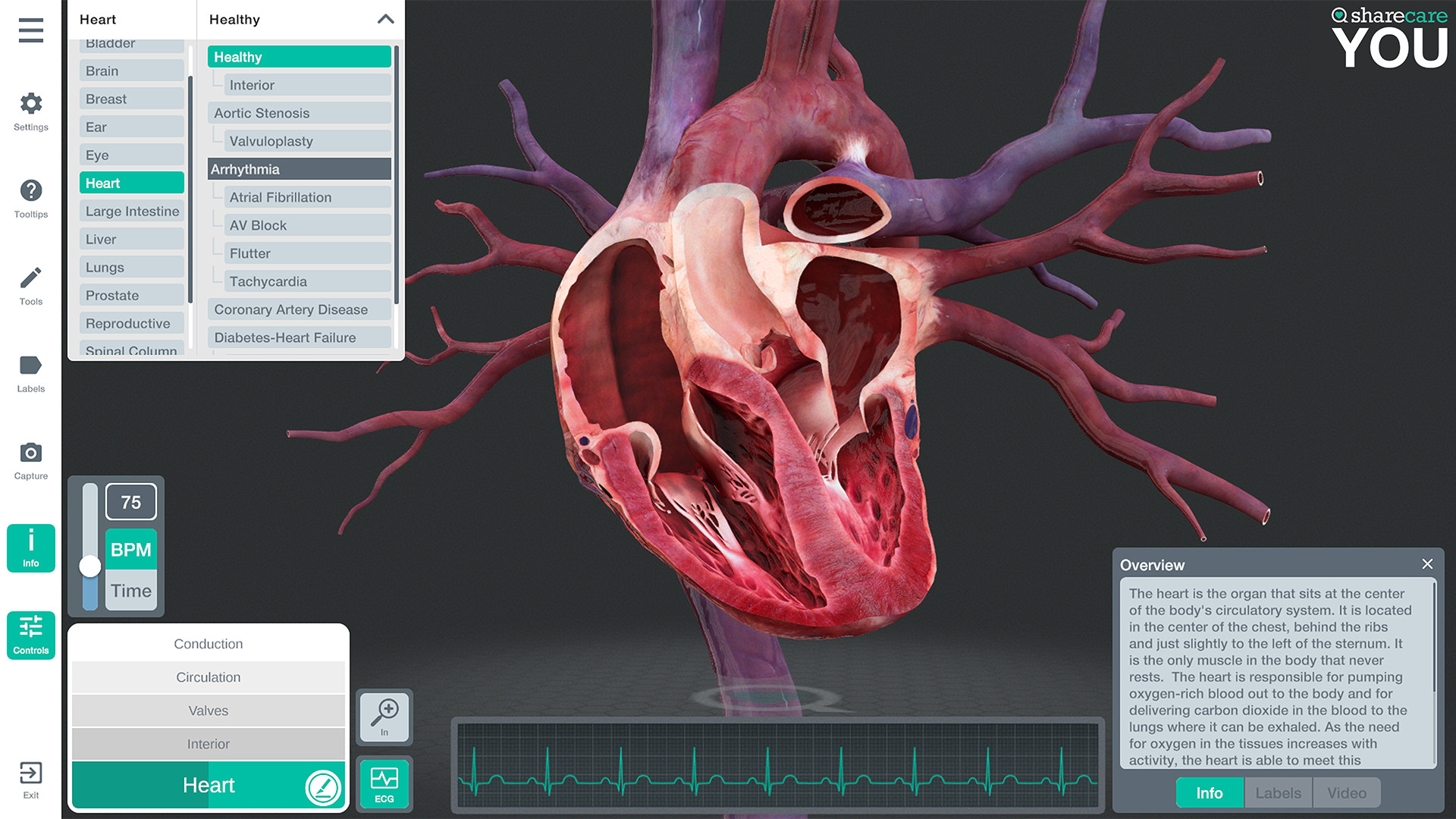 Oculus Quest 游戏《器官解刨学》Sharecare YOU Anatomy VR